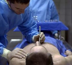 Бальзамування